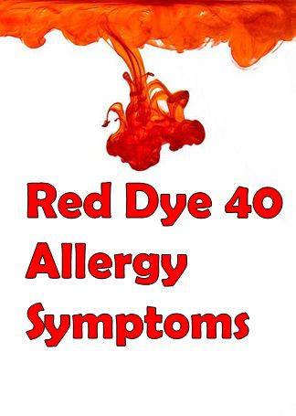 red dye allergy symptoms and prevention