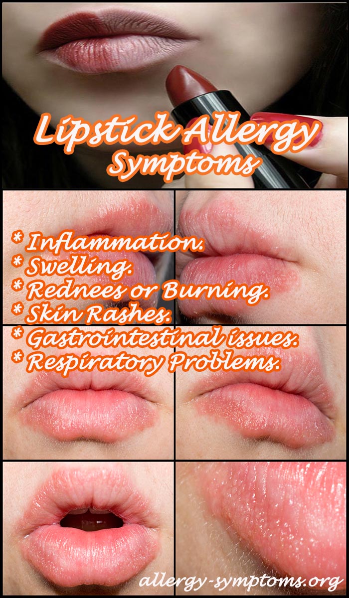 lipstick allergy symptoms