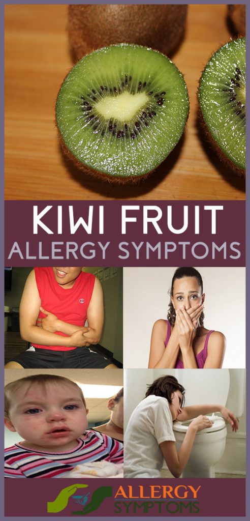 kiwi fruit allergy symptoms