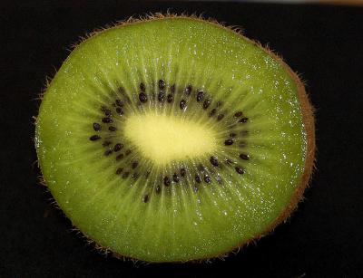 symptoms and causes of kiwi fruit allergy