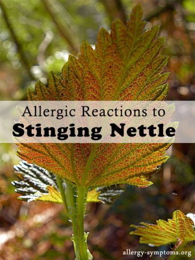 nettle allergy