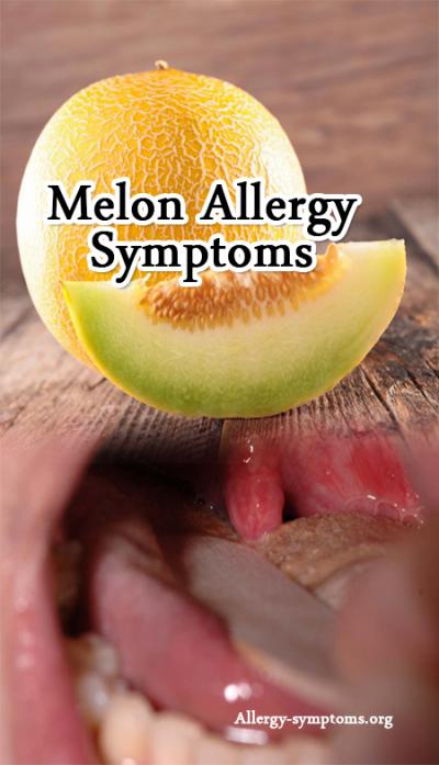 melon-allergy