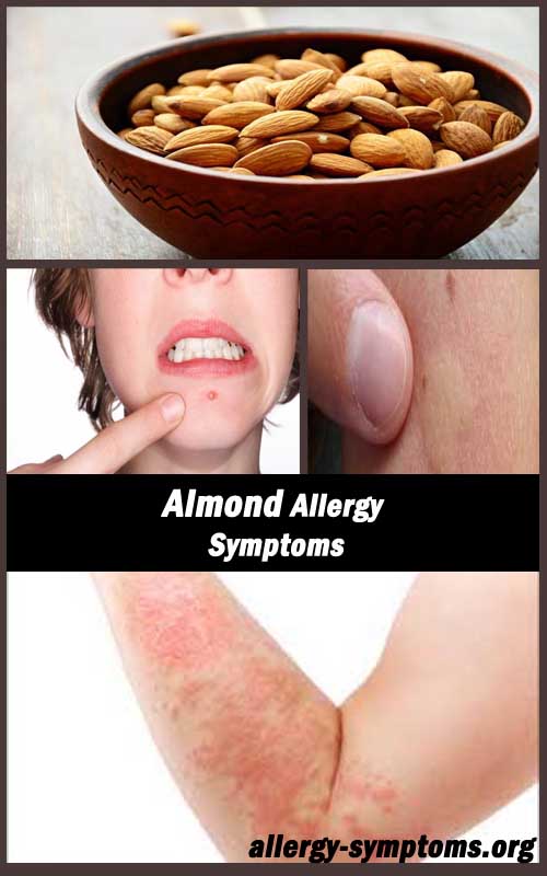 almond allergy