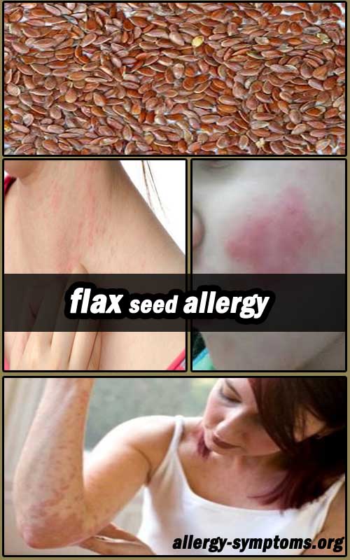 flax seed allergy