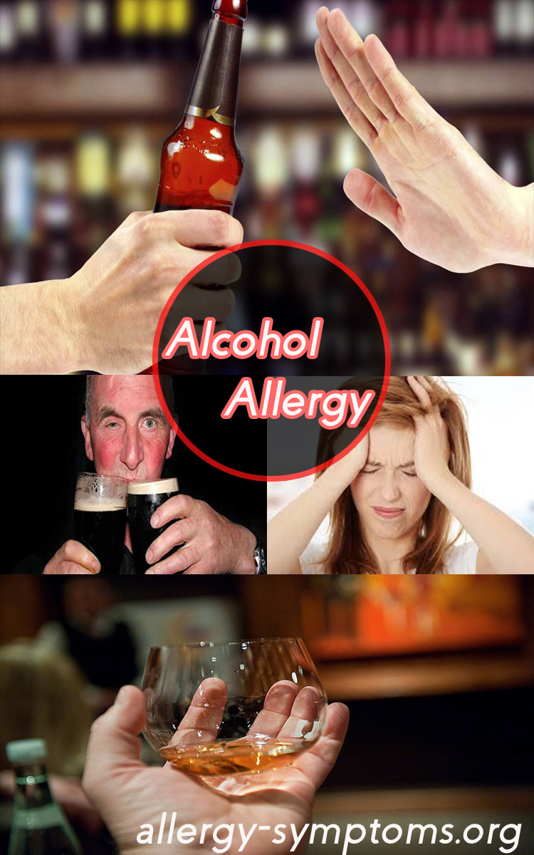 alcohol allergy