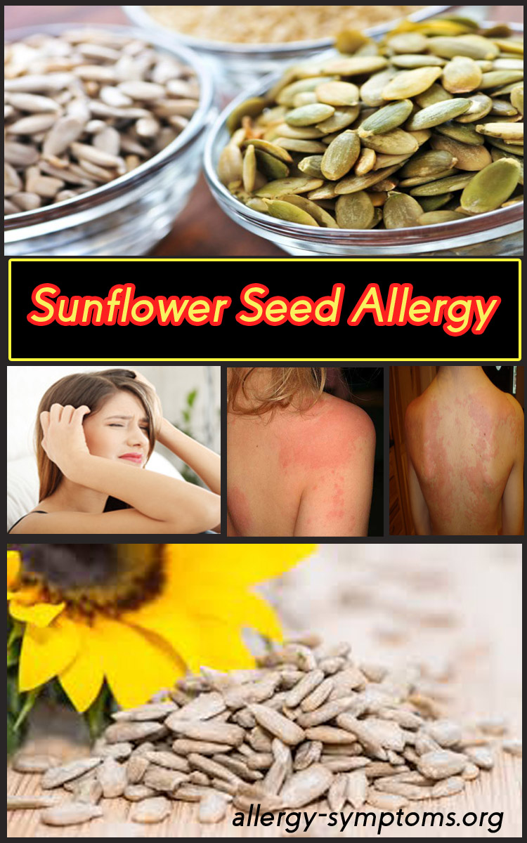 sunflower allergy cross reactivity