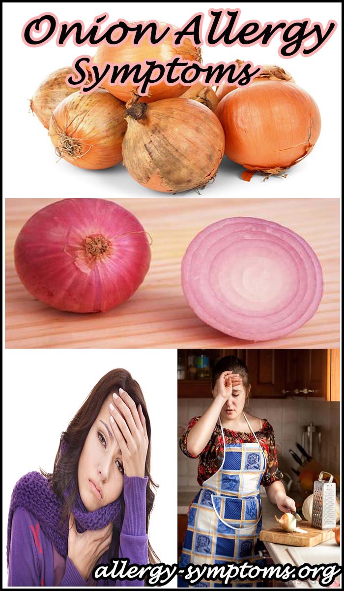 Onion Allergy Symptoms And Diagnosis Allergy Symptoms