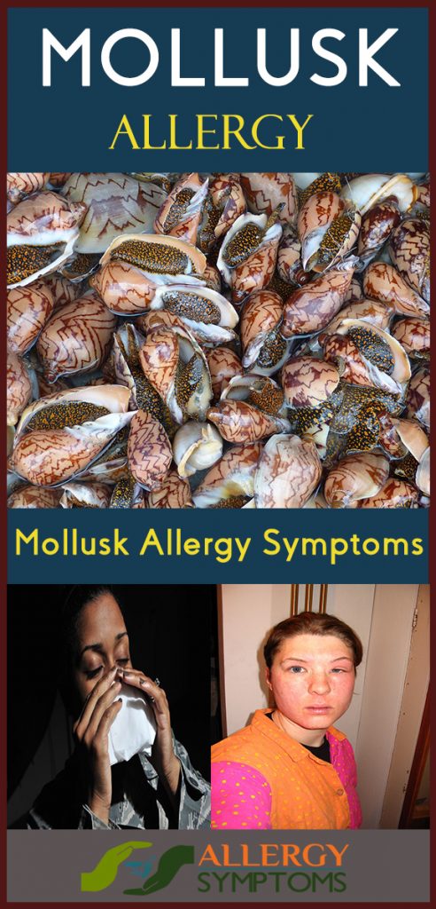 Mollusk Allergy