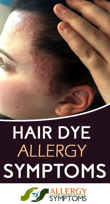 HAIR DYE ALLERGY SYMPTOMS_1