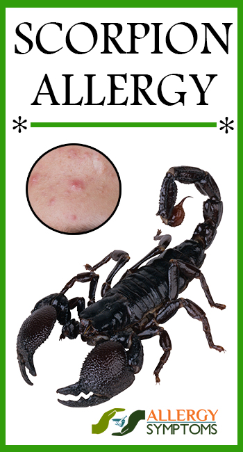 Scorpion Allergy