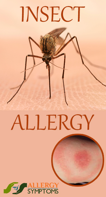 Insect Allergy