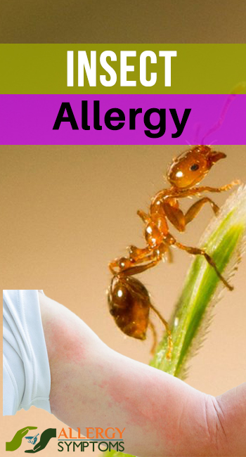 Insect Allergy 1