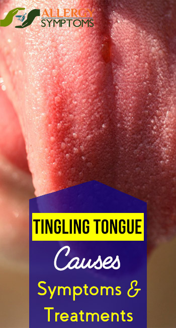 Tingling Tongue Treatments