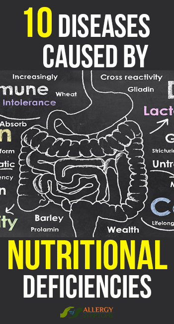 10 Diseases Caused By Nutritional Deficiencies