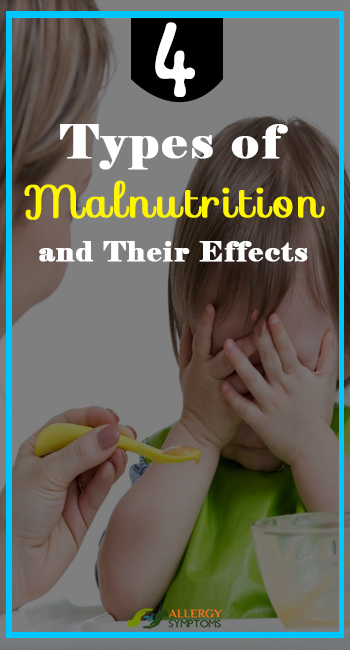 4 Types of Malnutrition and Their Effects
