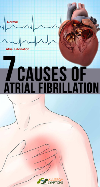 atrial flutter atrial fibrillation symptoms