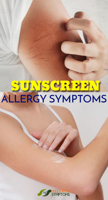 Sunscreen Allergy Symptoms