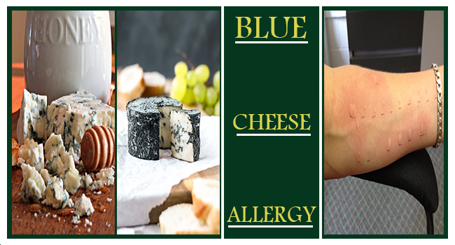 cheese allergy symptoms