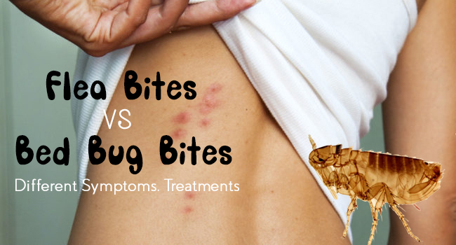 does your body reacto to bed bug bites less over time