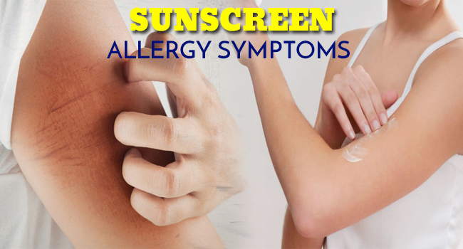 Sunscreen Allergy Symptoms Allergy Symptoms Org   Sunscreen Allergy Symptoms Fb 