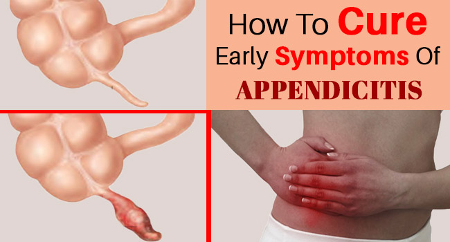 How Is Appendicitis Pain Described