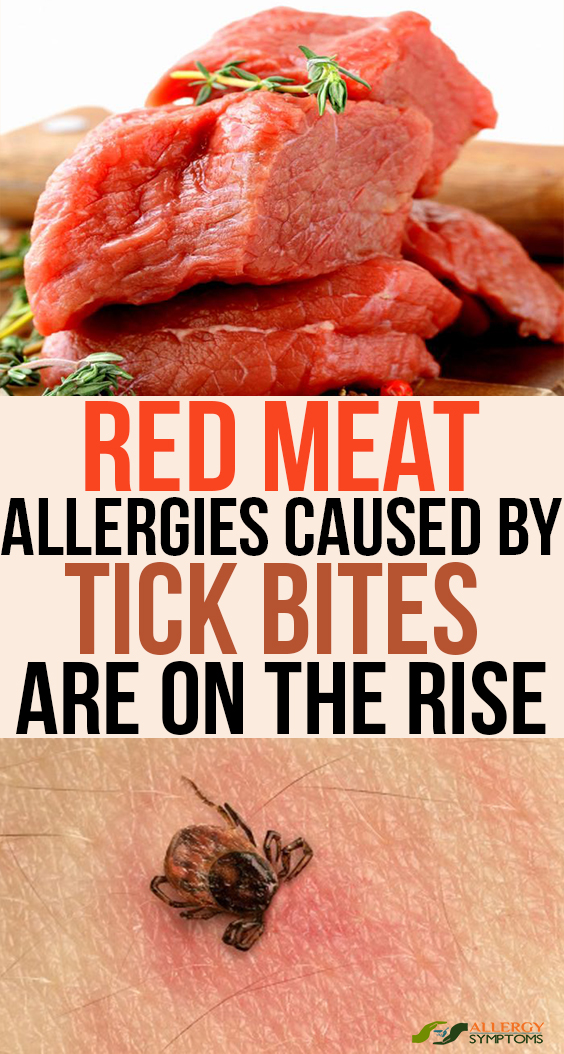 Red Meat Allergies Caused By Tick Bites Are On The Rise