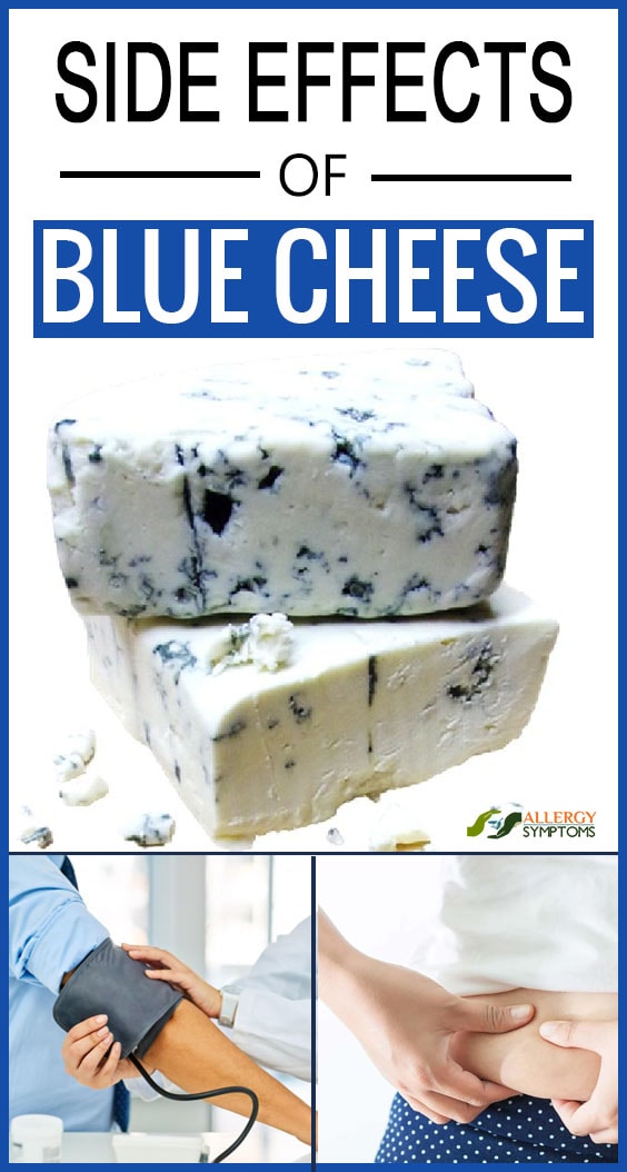 Side Effects of Blue Cheese Allergy Symptoms