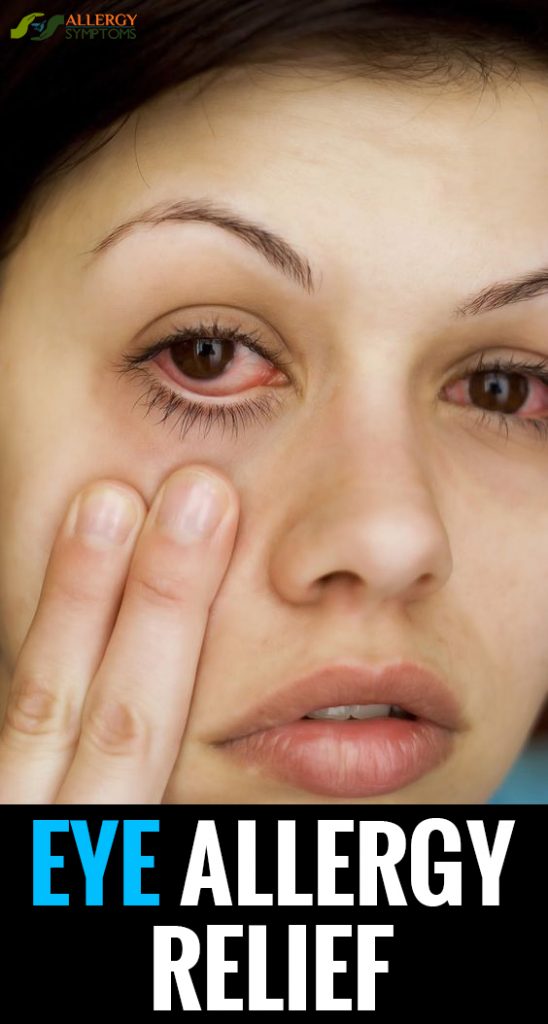 eye allergy symptoms, eye allergy relie, eye allergy